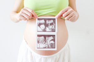 エコー画像を持つ妊婦